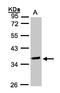 O-Sialoglycoprotein Endopeptidase antibody, LS-C185740, Lifespan Biosciences, Western Blot image 