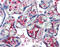 NME/NM23 Nucleoside Diphosphate Kinase 1 antibody, 51-966, ProSci, Immunohistochemistry frozen image 