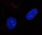 RAD51 Recombinase antibody, ab63801, Abcam, Immunocytochemistry image 
