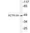 Activin A Receptor Type 2A antibody, LS-C177710, Lifespan Biosciences, Western Blot image 
