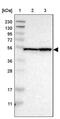 Notchless Homolog 1 antibody, PA5-53850, Invitrogen Antibodies, Western Blot image 