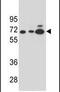 Amylase Alpha 2B (Pancreatic) antibody, PA5-24187, Invitrogen Antibodies, Western Blot image 