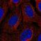 Phospholipase A2 Group XIIB antibody, NBP2-31685, Novus Biologicals, Immunofluorescence image 