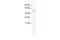 Transmembrane Protein 108 antibody, NBP1-57849, Novus Biologicals, Western Blot image 