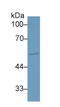 Activin A Receptor Type 1 antibody, LS-C419850, Lifespan Biosciences, Western Blot image 