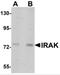 Interleukin 1 Receptor Associated Kinase 1 antibody, PM-5315, ProSci, Western Blot image 