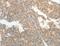 ATP Binding Cassette Subfamily B Member 11 antibody, LS-C402585, Lifespan Biosciences, Immunohistochemistry paraffin image 