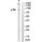 Leukocyte Receptor Tyrosine Kinase antibody, A04217, Boster Biological Technology, Western Blot image 