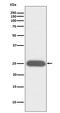 G-CSF antibody, M02280-1, Boster Biological Technology, Western Blot image 