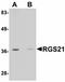 Regulator Of G Protein Signaling 21 antibody, LS-B5004, Lifespan Biosciences, Western Blot image 