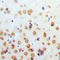 HIF1-alpha antibody, LS-C354017, Lifespan Biosciences, Immunohistochemistry paraffin image 