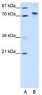 TOX high mobility group box family member 4 antibody, TA343755, Origene, Western Blot image 