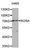 RAR Related Orphan Receptor A antibody, orb373510, Biorbyt, Western Blot image 