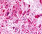 Adhesion G Protein-Coupled Receptor L3 antibody, TA316971, Origene, Immunohistochemistry paraffin image 