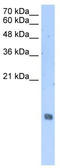 Histone Cluster 2 H2A Family Member A4 antibody, TA339215, Origene, Western Blot image 