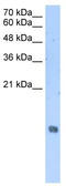 Histone Cluster 2 H2A Family Member A4 antibody, TA339215, Origene, Western Blot image 