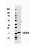 AKT Serine/Threonine Kinase 2 antibody, orb345019, Biorbyt, Western Blot image 