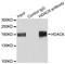 Histone Deacetylase 6 antibody, STJ113748, St John