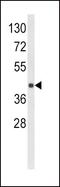 Major Histocompatibility Complex, Class I, E antibody, GTX81202, GeneTex, Western Blot image 