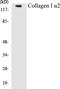 Collagen Type I Alpha 2 Chain antibody, EKC1127, Boster Biological Technology, Western Blot image 