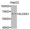 Solute Carrier Family 6 Member 1 antibody, STJ110041, St John