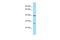 Phosphatidylserine Decarboxylase antibody, A05625, Boster Biological Technology, Western Blot image 