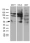 Estrogen Receptor 2 antibody, LS-C793824, Lifespan Biosciences, Western Blot image 