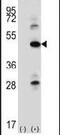 Integrin Linked Kinase antibody, PA5-14683, Invitrogen Antibodies, Western Blot image 