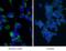 Microtubule Associated Protein 1 Light Chain 3 Alpha antibody, 12135-1-AP, Proteintech Group, Immunofluorescence image 