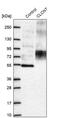 Chloride Voltage-Gated Channel 7 antibody, PA5-60203, Invitrogen Antibodies, Western Blot image 