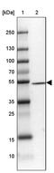 DENN Domain Containing 2D antibody, PA5-60444, Invitrogen Antibodies, Western Blot image 