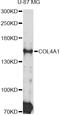 Collagen Type IV Alpha 1 Chain antibody, abx125698, Abbexa, Western Blot image 