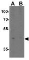 T Cell Immunoglobulin And Mucin Domain Containing 4 antibody, GTX31299, GeneTex, Western Blot image 