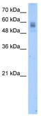 Protein C, Inactivator Of Coagulation Factors Va And VIIIa antibody, TA346173, Origene, Western Blot image 