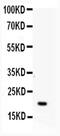 Adenine Phosphoribosyltransferase antibody, PA5-78804, Invitrogen Antibodies, Western Blot image 