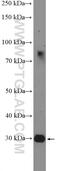 Homeobox D12 antibody, 22684-1-AP, Proteintech Group, Western Blot image 