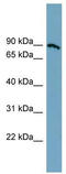 Solute Carrier Family 6 Member 14 antibody, TA333895, Origene, Western Blot image 