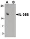 Interleukin 36 Beta antibody, PA5-38032, Invitrogen Antibodies, Western Blot image 