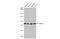 Acyl-CoA Synthetase Long Chain Family Member 4 antibody, GTX100260, GeneTex, Western Blot image 
