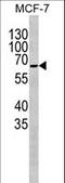 Mitochondrially Encoded Cytochrome C Oxidase I antibody, LS-C166973, Lifespan Biosciences, Western Blot image 