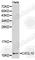 C-X-C Motif Chemokine Ligand 10 antibody, A1457, ABclonal Technology, Western Blot image 