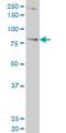 T-Box 3 antibody, H00006926-M06, Novus Biologicals, Western Blot image 