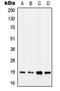Myosin Light Chain 7 antibody, LS-C353509, Lifespan Biosciences, Western Blot image 