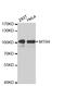 Mtr4 Exosome RNA Helicase antibody, TA332776, Origene, Western Blot image 