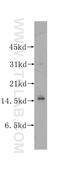6-Pyruvoyltetrahydropterin Synthase antibody, 12150-1-AP, Proteintech Group, Western Blot image 