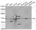 Lamin B Receptor antibody, A5468, ABclonal Technology, Western Blot image 