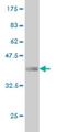 Ubiquitin Protein Ligase E3 Component N-Recognin 3 antibody, H00130507-M01, Novus Biologicals, Western Blot image 