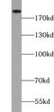 TSC Complex Subunit 2 antibody, FNab09100, FineTest, Western Blot image 