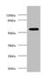 Succinyl-CoA:3-ketoacid-coenzyme A transferase 1, mitochondrial antibody, CSB-PA017306LA01HU, Cusabio, Western Blot image 