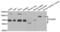 Interferon Gamma Receptor 1 antibody, abx004397, Abbexa, Western Blot image 